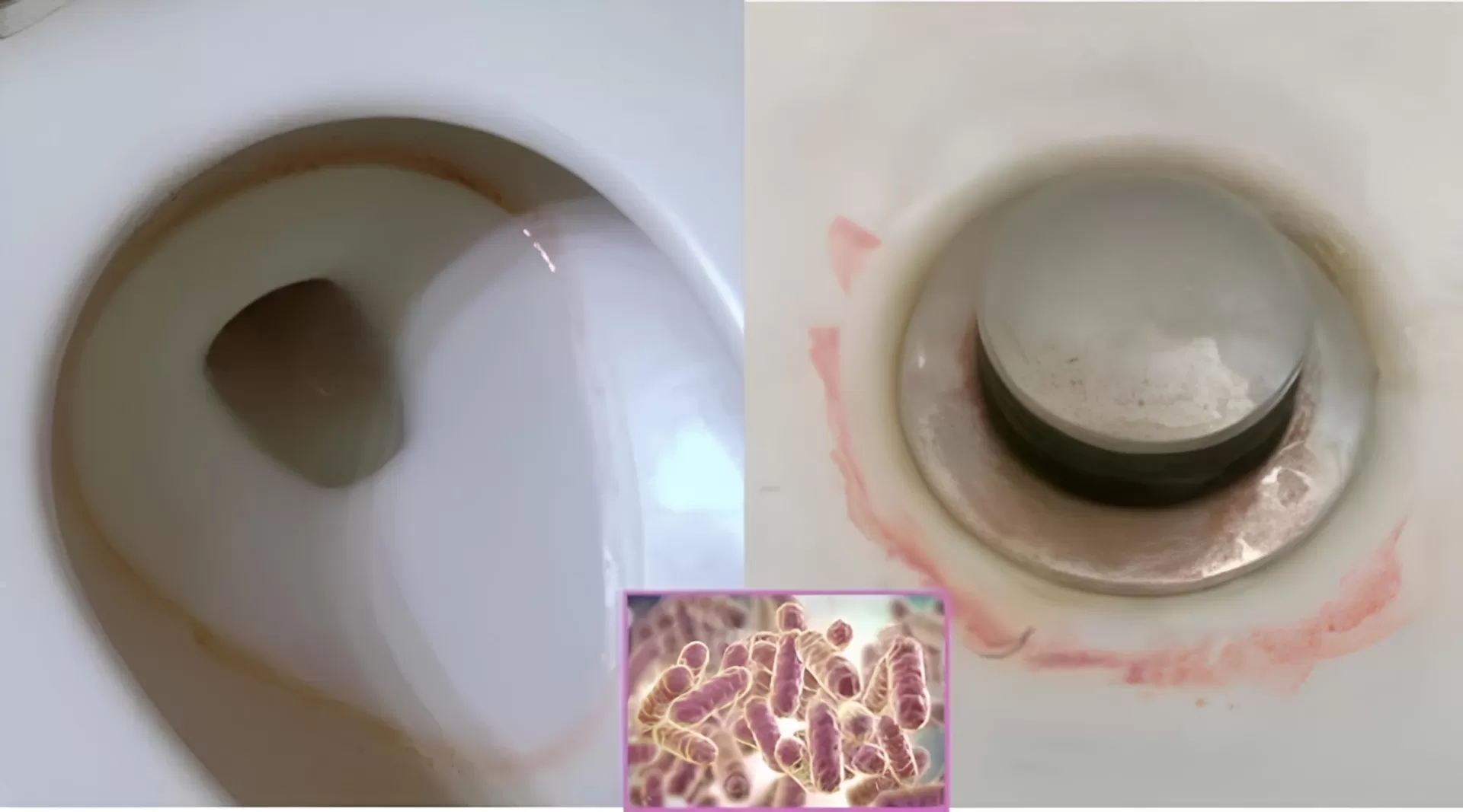 ‘Không phải cặn xà phòng’… Sự thật gây sốc về vết bẩn trong nhà vệ sinh